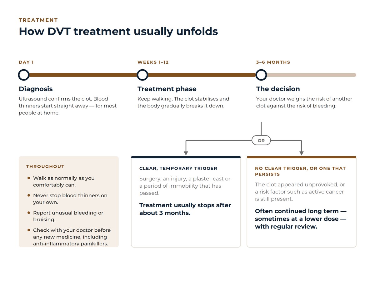 Timeline of DVT treatment from diagnosis, through a three-month treatment phase, to a decision at three to six months to stop treatment after a temporary trigger or continue long term if there was no clear trigger.